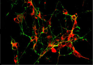 Photo of cultured neuron monolayer