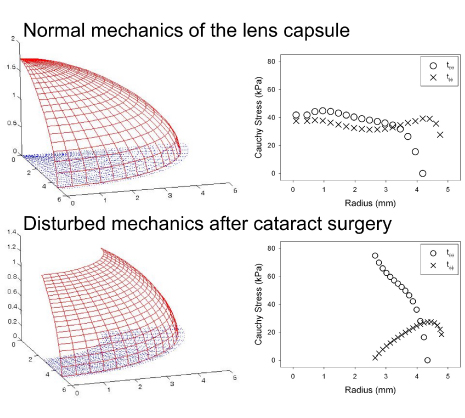 Image: Regional mechanical properties and stress analysis of the human anterior lens capsule