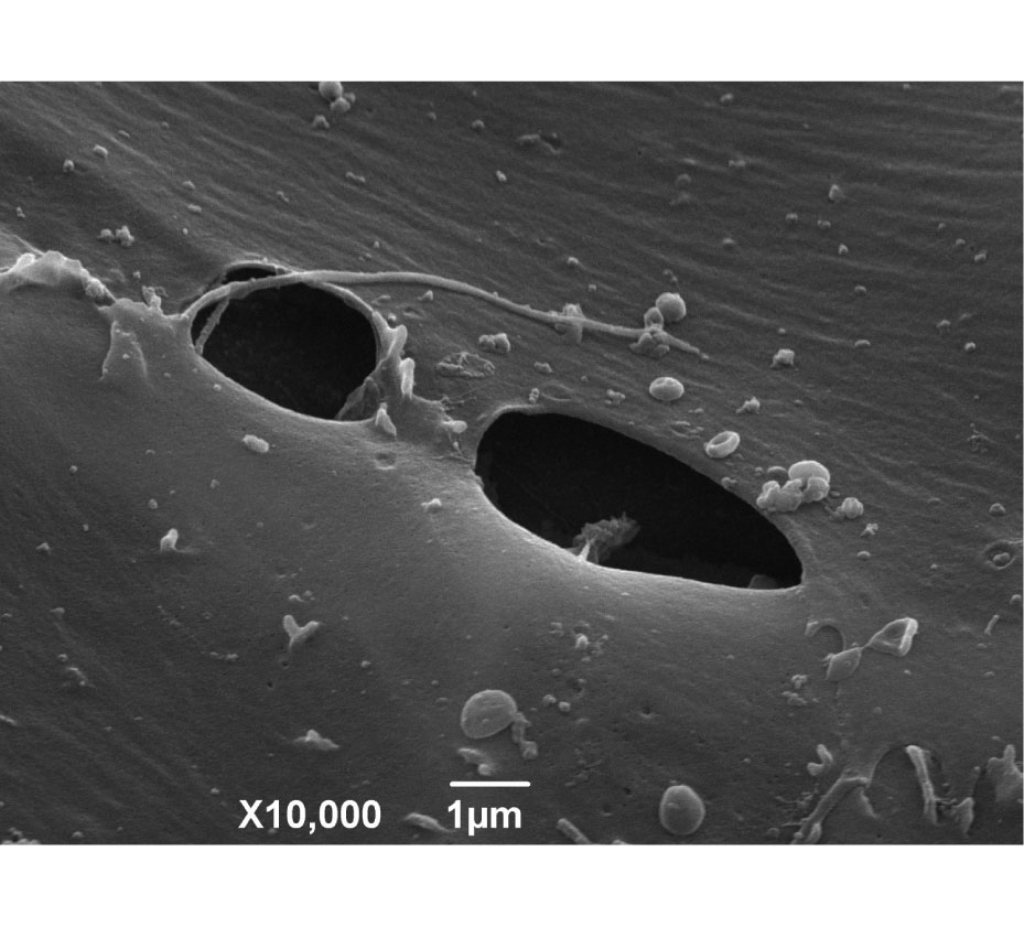 Image: Altered mechanobiology of Schlemm's canal endothelial cells in glaucoma