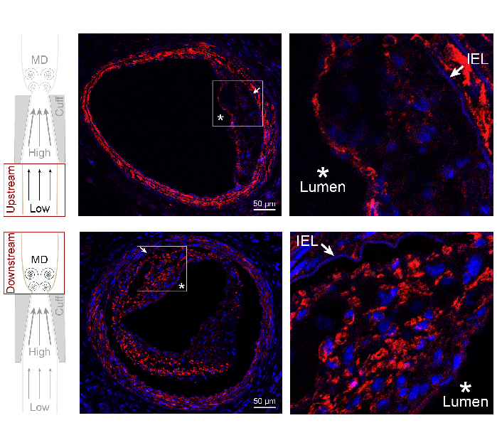 Image: Smooth muscle cells affect differential nanoparticle accumulation in disturbed blood flow-induced murine atherosclerosis
