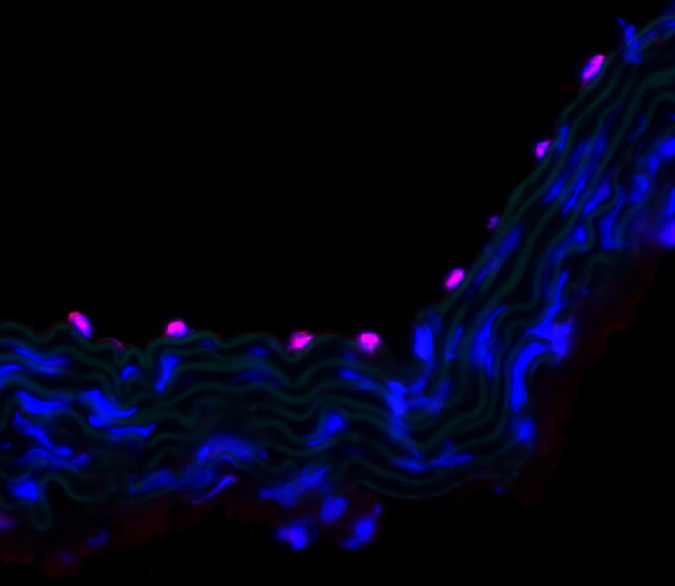 A historical section portion from a mouse aorta with overlapping nuclear (DAPI; blue), KLF2 (red), and elastin (green) stainings. KLF2 is a principal atheroprotective transcription factor in endothelial cells that is activated under normal flow conditions.